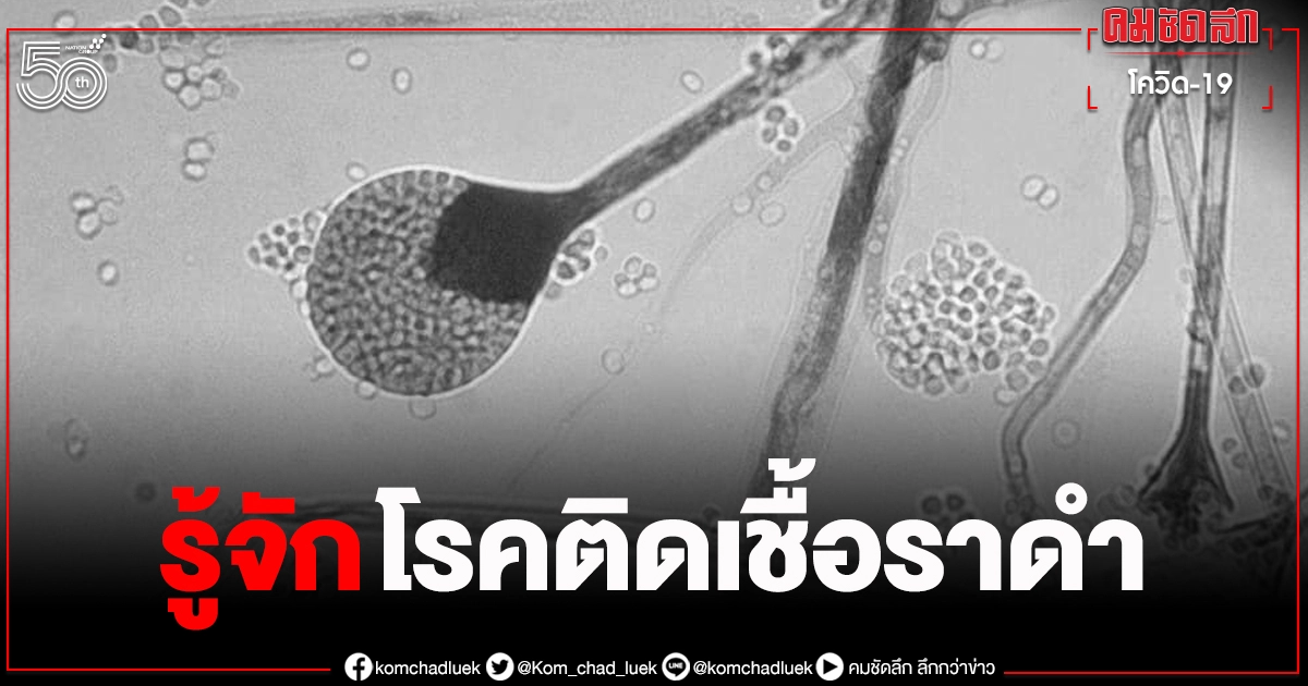 "โรคติดเชื้อราดำ" โยง "โควิด" ที่เราควรรู้ รักษายากมากต้องผ่าตัดกระดูก-เอาลูกตาออก