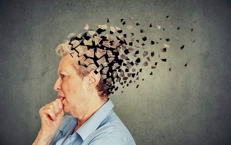 เช็กลิสต์ 10 สัญญาณเตือน "โรคอัลไซเมอร์" พร้อมแนะ 5 วิธีป้องกันง่ายๆ