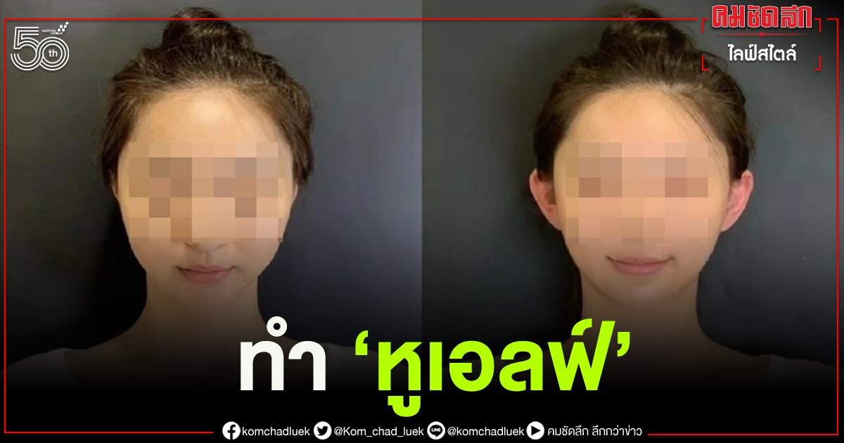 วัยรุ่นจีนแห่ทำศัลยกรรม "หูเอลฟ์" เสริมความสวยหล่อ เชื่อ ช่วยให้หน้าดูเรียวเล็ก-เด็กลง วัยรุ่นจีนแห่ทำศัลยกรรม "หูเอลฟ์" เสริมความสวยหล่อ เชื่อ ช่วยให้หน้าดูเรียวเล็ก-เด็กลง