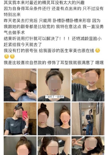 วัยรุ่นจีนแห่ทำศัลยกรรม "หูเอลฟ์" เสริมความสวยหล่อ เชื่อ ช่วยให้หน้าดูเรียวเล็ก-เด็กลง