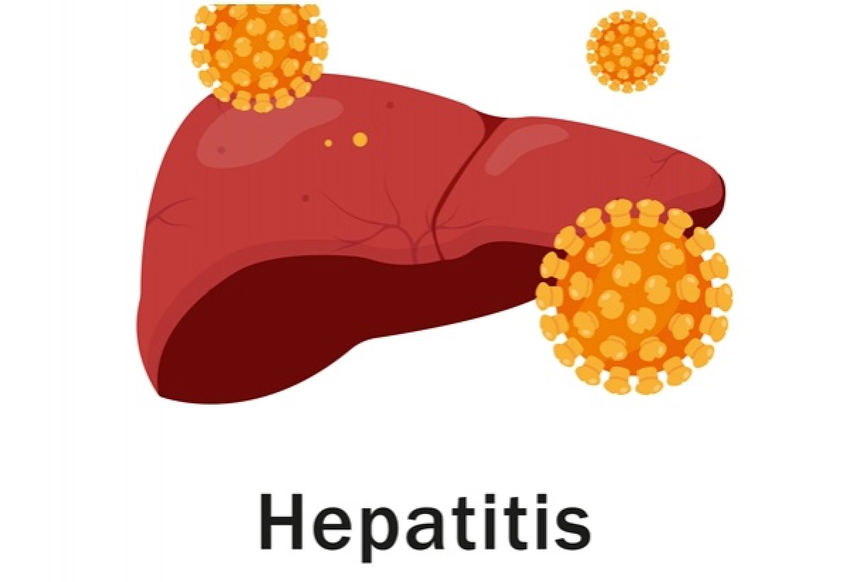 รู้จัก "โรคไวรัสตับอักเสบซี" ภัยเงียบที่ยังไร้วัคซีน