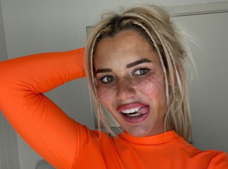 เตือนภัย สาวอยาก "หน้ามีกระ" ผิวดูฉ่ำแดดเก๋ๆ ระวังหน้าพัง หากทำตามวิธีผิดๆ