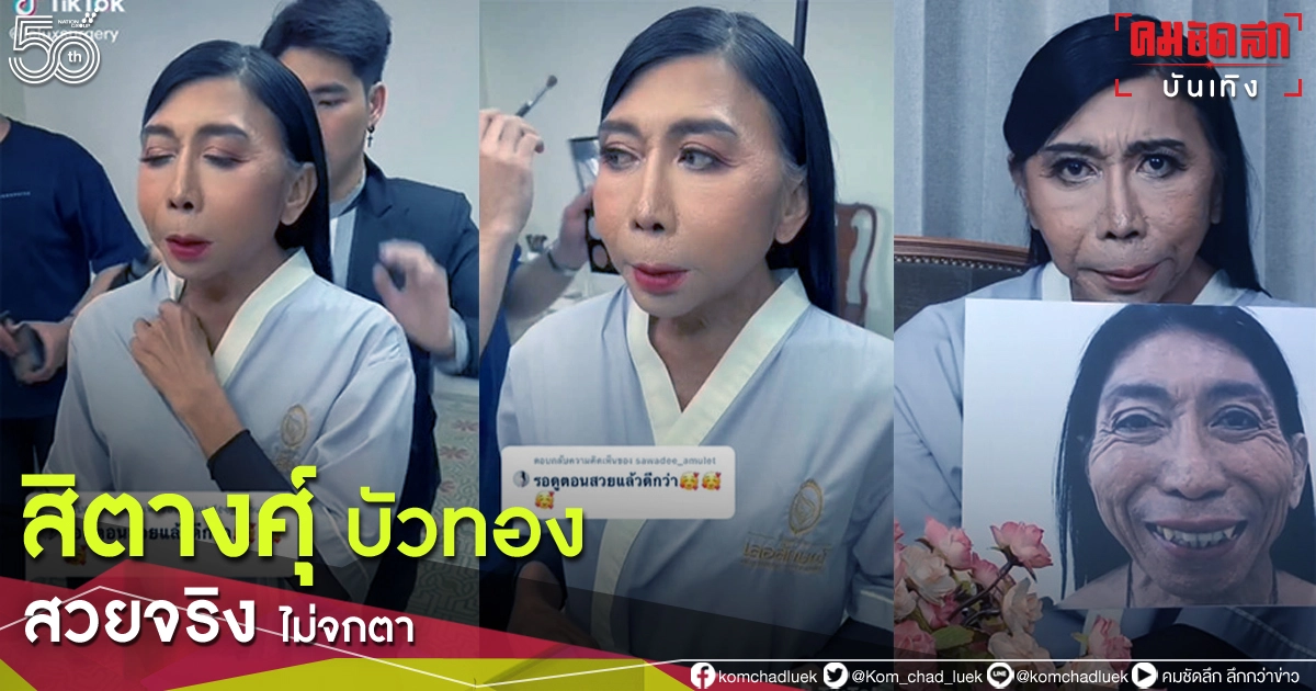 อัพเดทหน้าล่าสุด "สิตางศุ์ บัวทอง" หลังศัลยกรรมได้ 9 วัน เริ่มสวยจริง ไม่จกตา อัพเดทหน้าล่าสุด "สิตางศุ์ บัวทอง" หลังศัลยกรรมได้ 9 วัน เริ่มสวยจริง ไม่จกตา