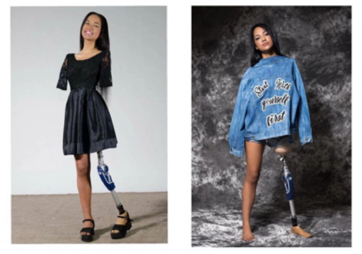 "นางงามใจสู้" มีขาเดียวไร้แขนทั้งสองข้างเข้ารอบ Finalists  Miss Ecuador 2021