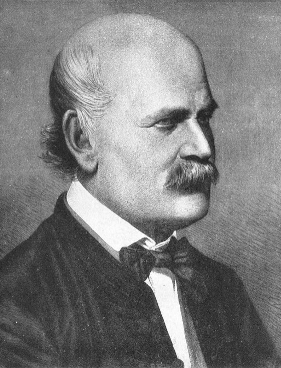 "ดร.อิกนาทซ์" คุณหมอสูฯ ผู้ค้นพบการ "ล้างมือ" ช่วยชีวิต 