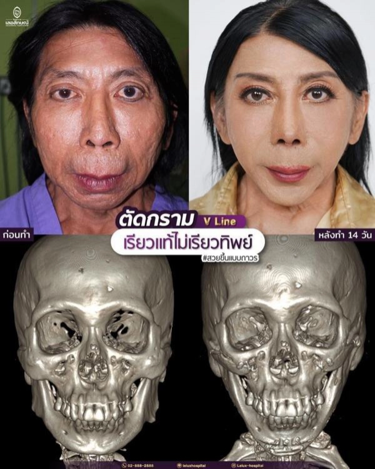 "แม่สิตางศุ์" อวดหน้าเซตใหม่ เรียวขึ้นแล้วนะ "ไม่ปังตรงไหน เอาปากกามาวง"