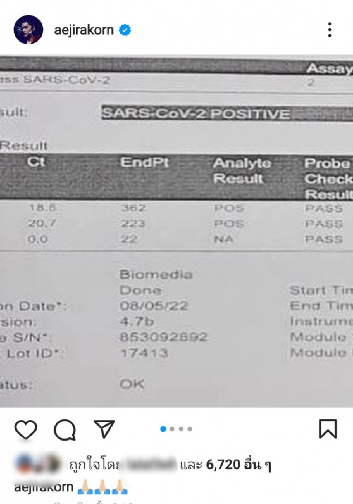 "เอ๊ะ จิรากร" กับ "ภรรยา"  ติดเชื้อโควิด  พร้อมแจ้งไทม์ไลน์ย้อนหลัง 