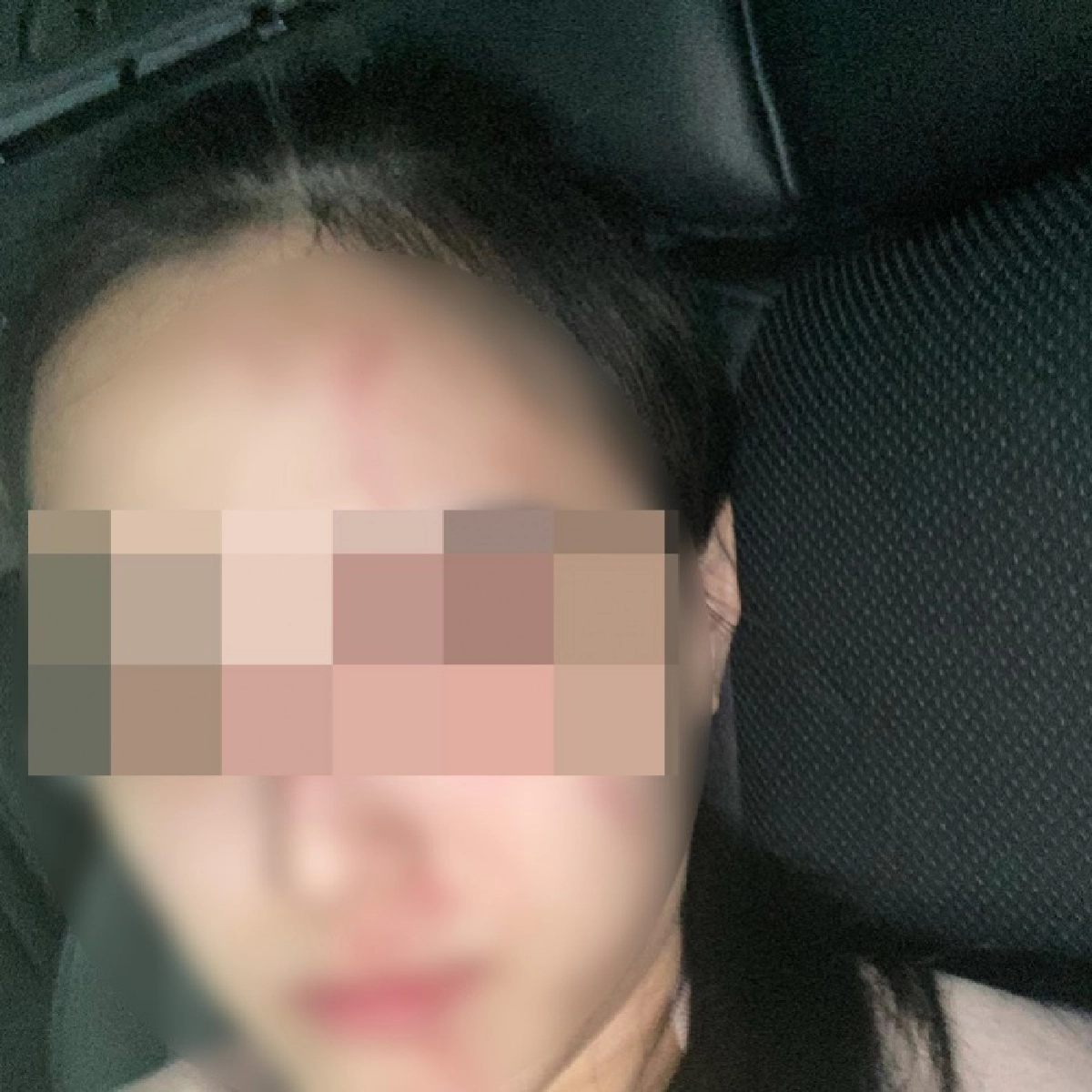 ย้อนข่าว พิม แฟนทอยทอย ถูกแฟนเก่าทำร้ายสมองเคลื่อน ที่มาโรคซึมเศร้า ก่อนพิมถูกทอยทอย แทงเสียชีวิต