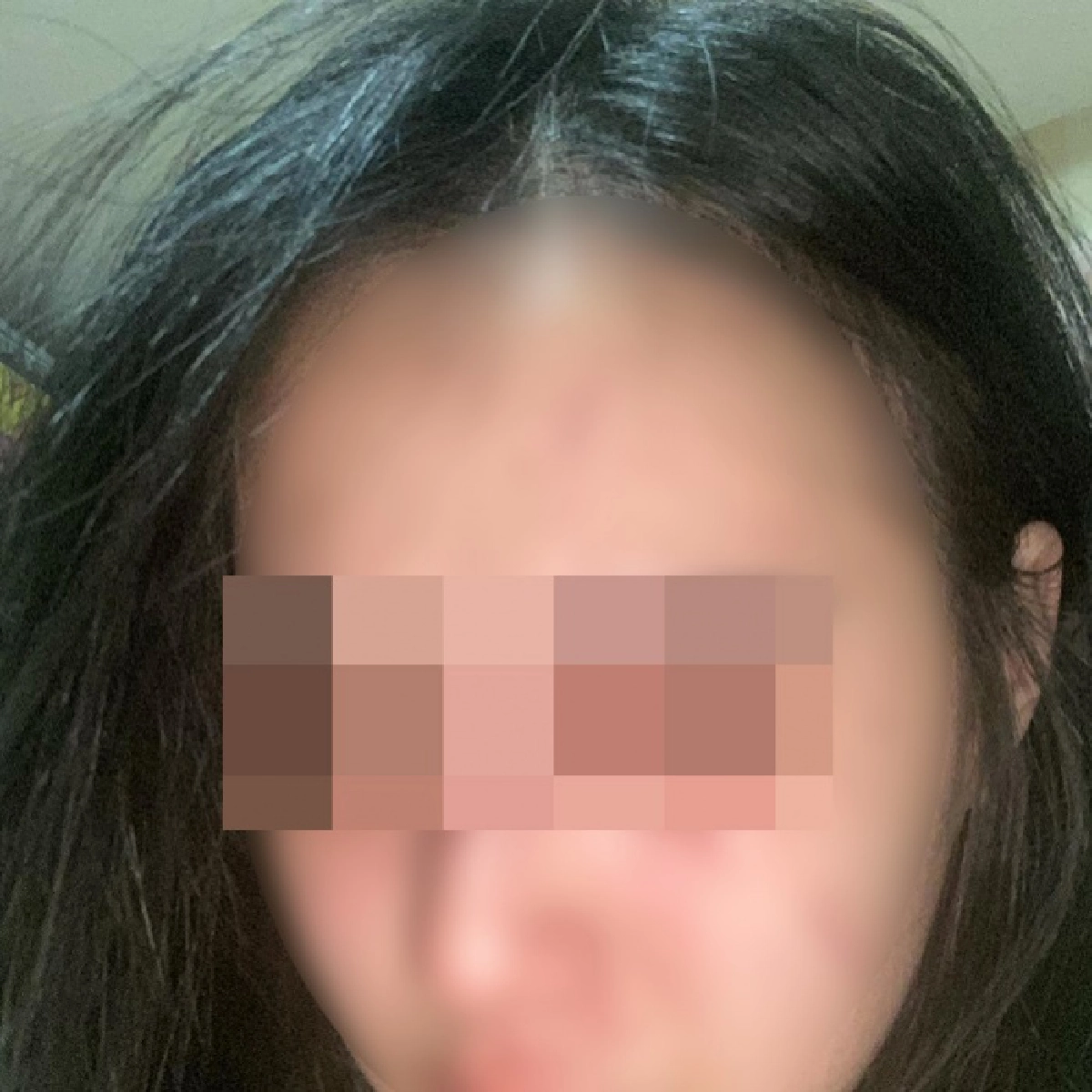 ย้อนข่าว พิม แฟนทอยทอย ถูกแฟนเก่าทำร้ายสมองเคลื่อน ที่มาโรคซึมเศร้า ก่อนพิมถูกทอยทอย แทงเสียชีวิต