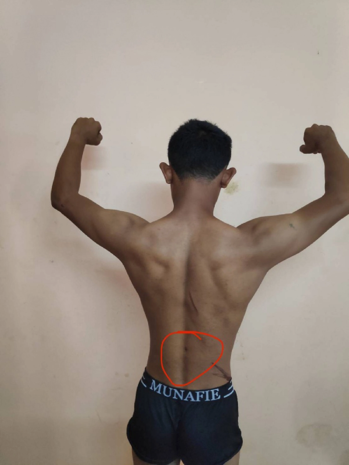 เปิดร่องรอยบาดแผลการต่อสู้  มัดคนร้ายฆ่า"แหม่มสวิสฯ"  ทิ้งศพน้ำตกโตนอ่าวยน 