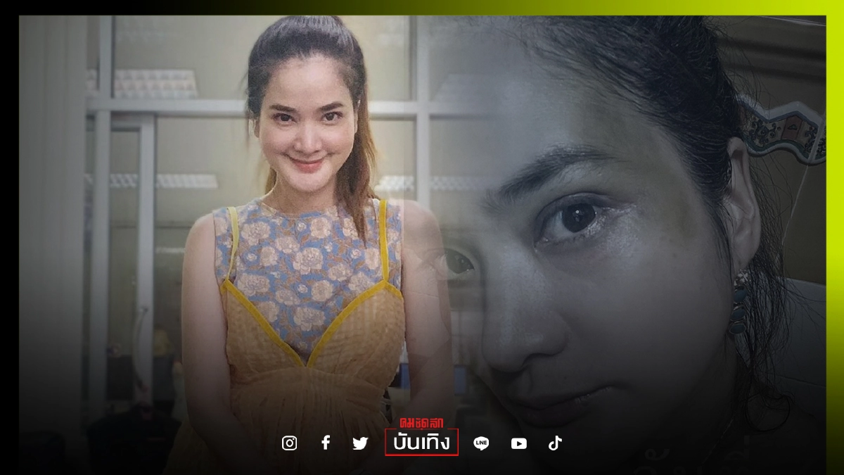 "ปอย ปวีณา" โพสต์ภาพใบหน้าช้ำ เหตุเล่นสเก็ตบอร์ด "ปอย ปวีณา" โพสต์ภาพใบหน้าช้ำ เหตุเล่นสเก็ตบอร์ด