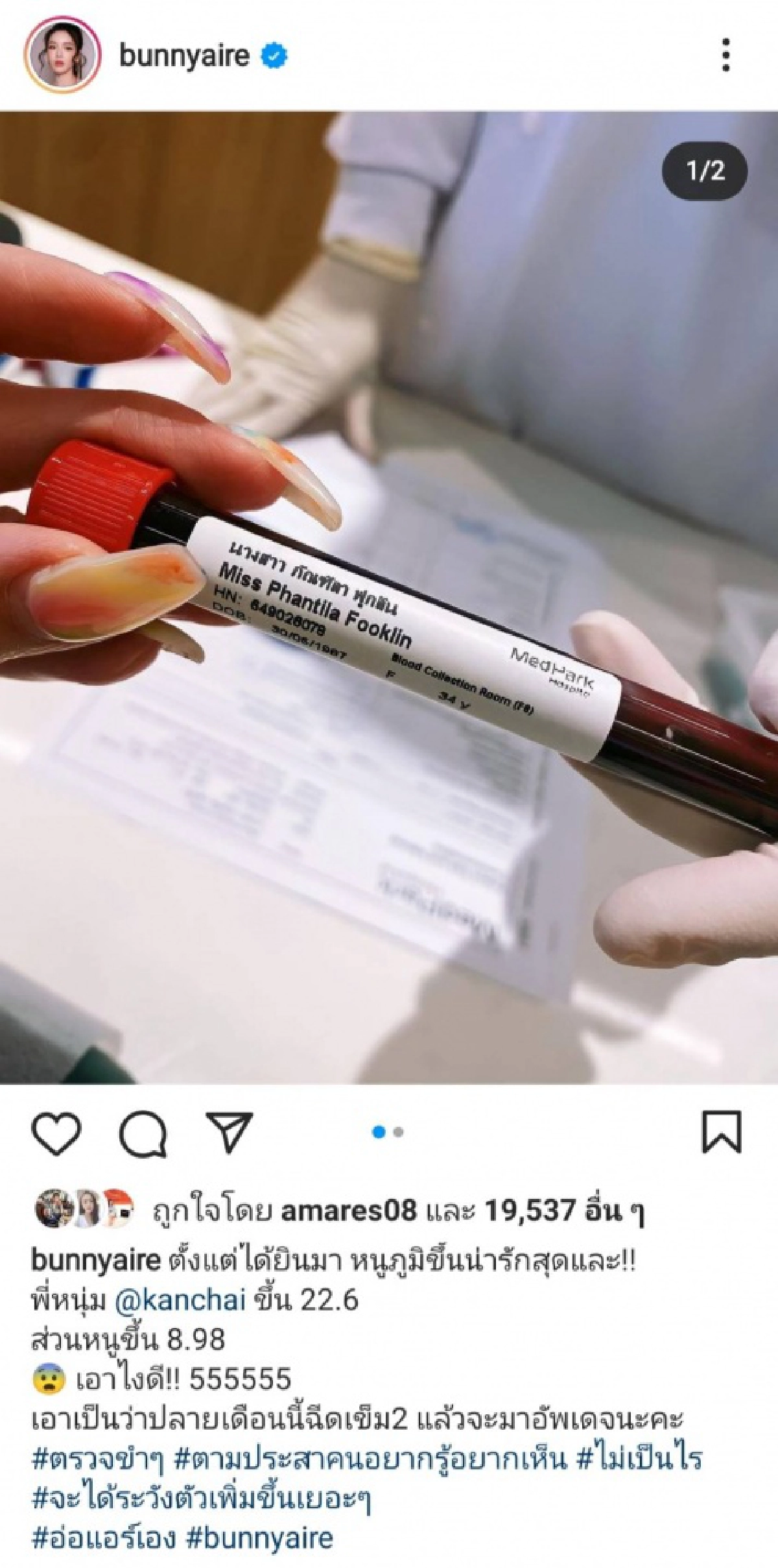  ช็อก "แอร์ ภัณฑิลา" เทียบผลตรวจภูมิ "หนุ่ม กรรชัย" ตัวเลขต่างกันมาก