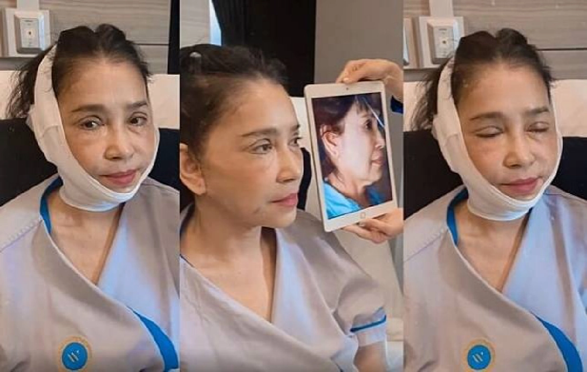 "แอ๊ว อำภา" โชว์หน้าใหม่หลังศัลยกรรม 1 เดือน เด็กลง 20 ปี