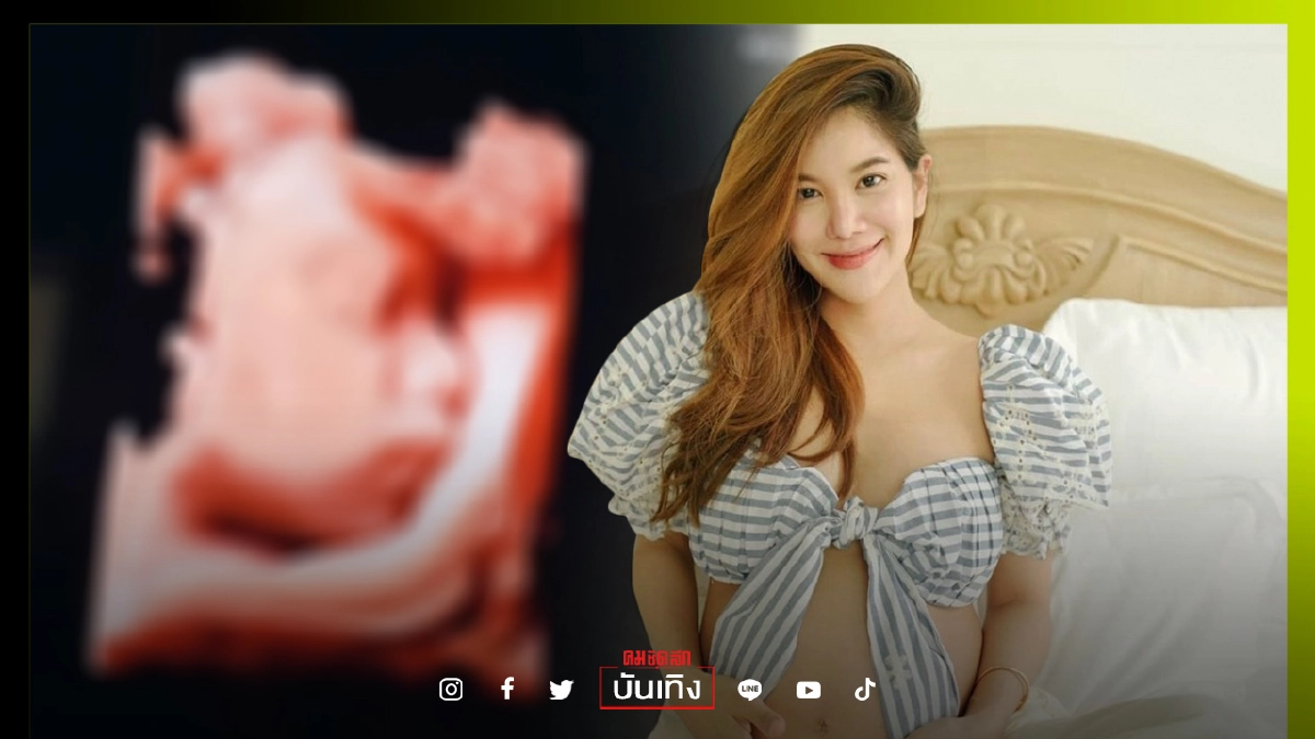 "ก้อย รัชวิน" เผยภาพอัลตร้าซาวด์ลูกชาย วัย 29 สัปดาห์