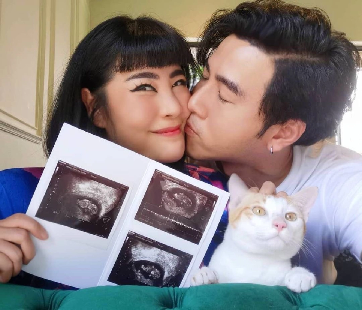 "โย่ง อาร์มแชร์"  โชว์ภาพอัลตราซาวด์ ลูกสาวคนแรก หลังครบ 32 สัปดาห์