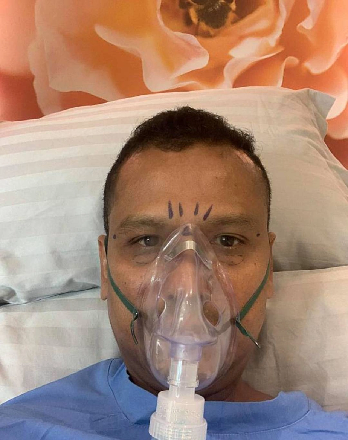 เปิดหน้าใหม่ "ไท ธนาวุฒิ" หลังผ่าตัดศัลยกรรมหนังตา