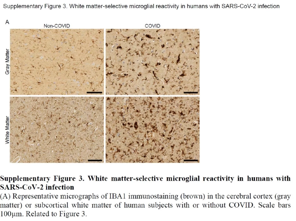 เบรคประกาศ "โควิด19" เป็นโรคประจำถิ่น ชี้ดูความไม่รุนแรงของโอไมครอนไม่ได้