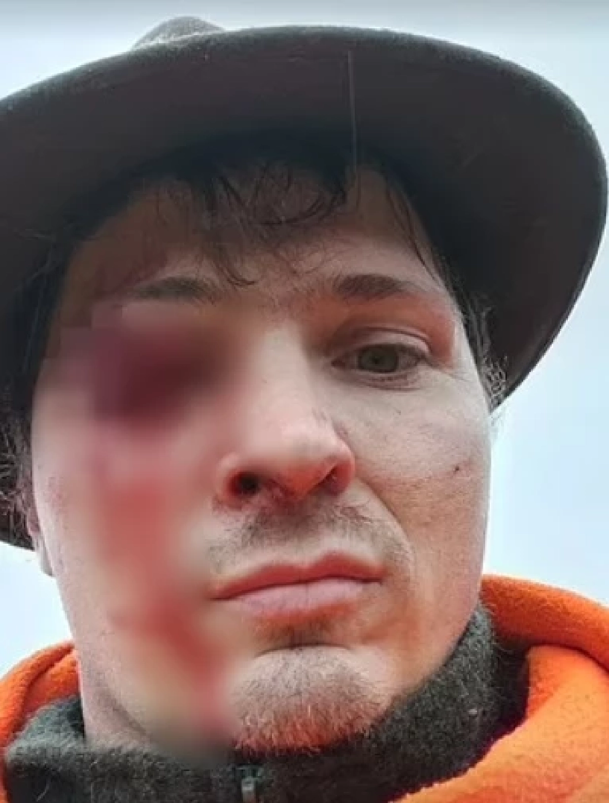 พรานยกปืนเตรียมส่อง เจอ "กวาง" วิ่งชนโจมตีก่อน เขาทิ่มตาสุดสยอง (คลิป)