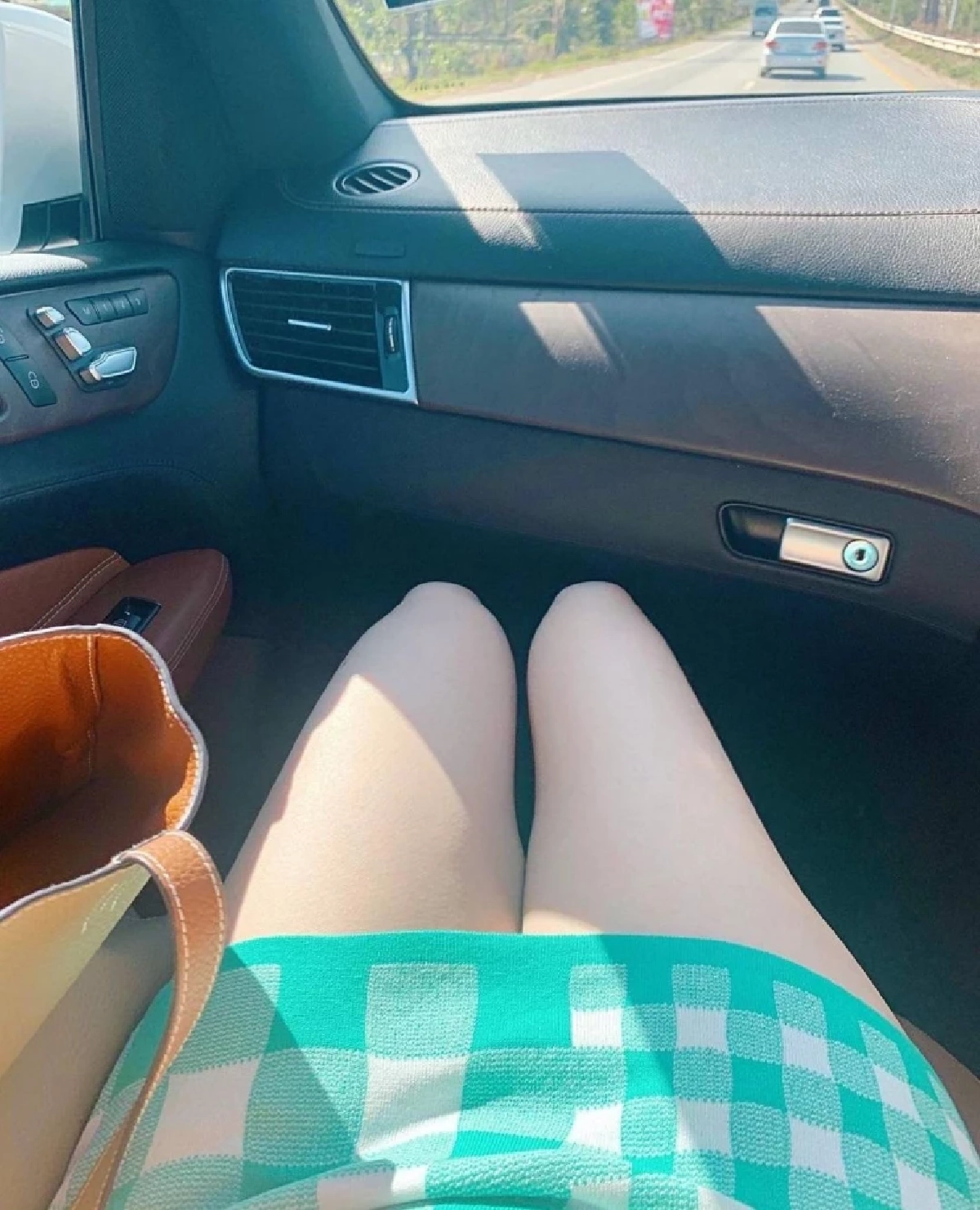 "ตู่ ปิยวดี" เผยภาพขาขวาลีบ หลังผ่าตัดหัวเข่า