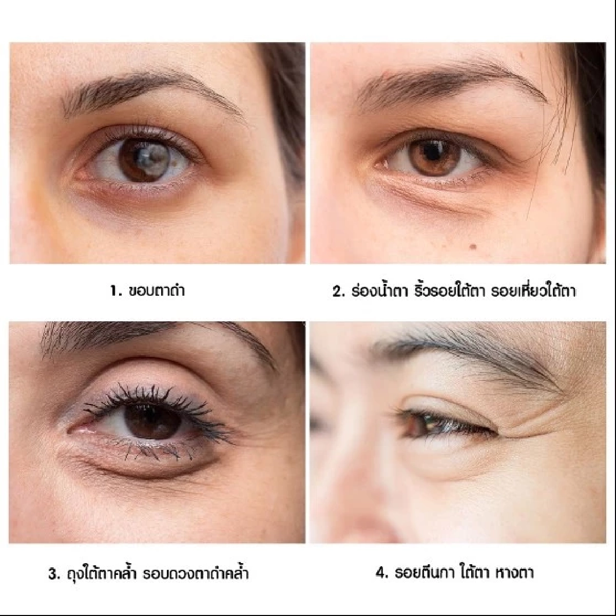 ปัญหาใต้ตา