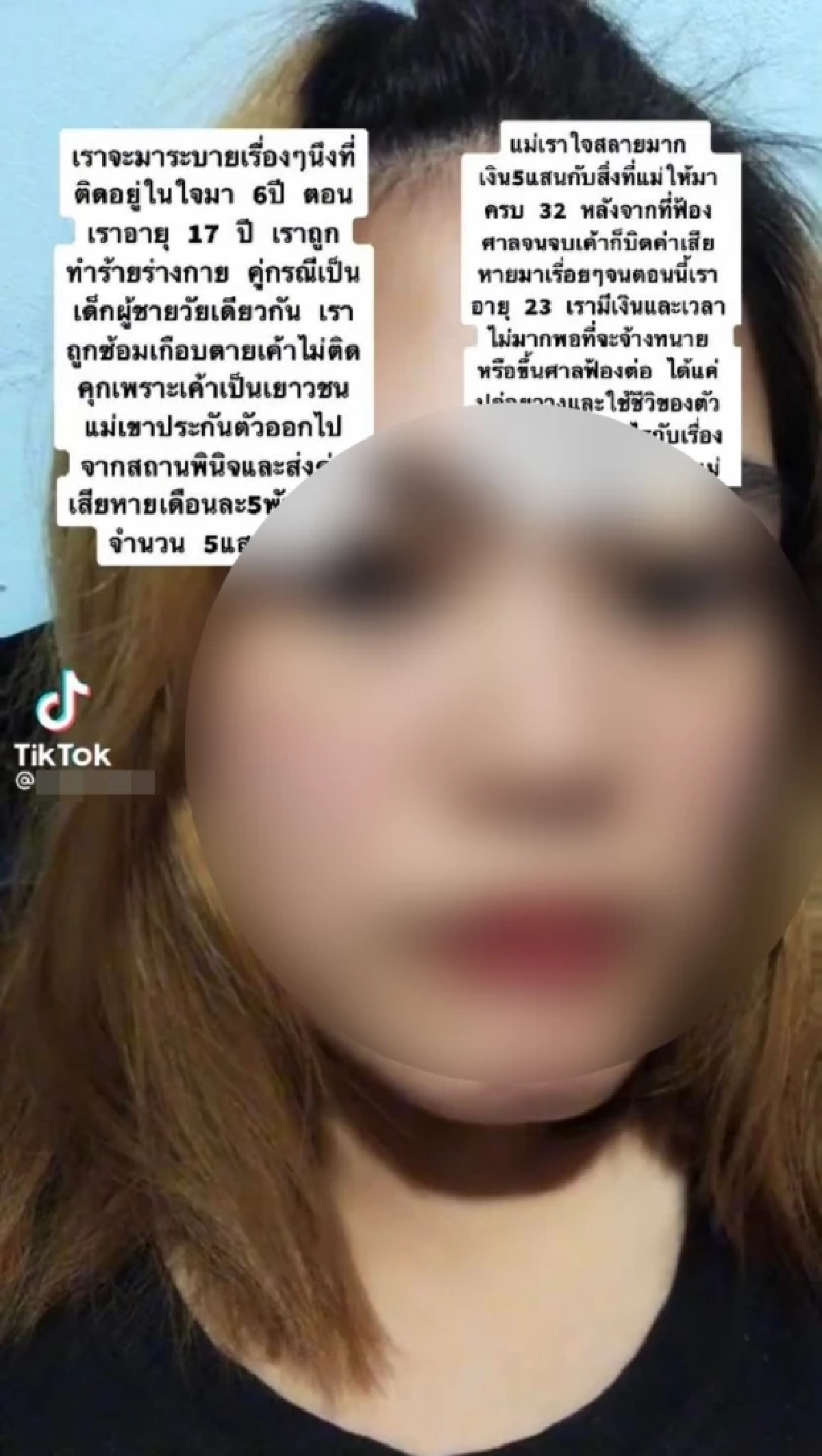 สาว, สาวถูกแฟนทำร้าย, ตาบอด, ตาเทียม