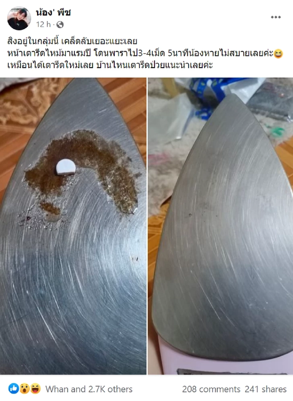 ชาวเน็ตแห่แชร์ "น้องเตารีดป่วย" ใช้ "ยาพารา" รักษาหาย เทคนิคแบบนี้ก็มีด้วย