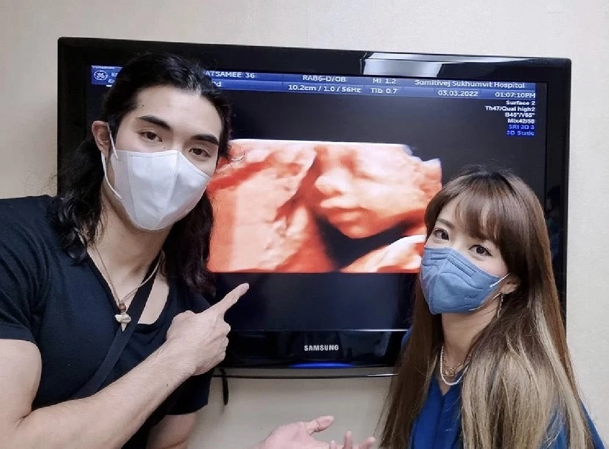 สุดห่วง "แนนนี่ เกิร์ลลี่เบอร์รี่" ติดโควิดขณะท้อง 6 เดือน รับกังวลมาก