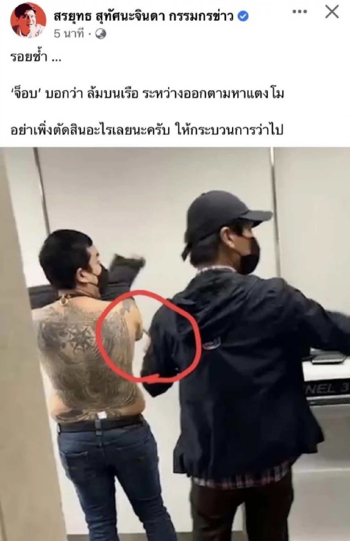 ชาวเน็ตแห่ขุดภาพวงจรปิด หลัง "ไฮโซปอ" สั่งทีมข่าวลบภาพบาดแผลบนร่าง