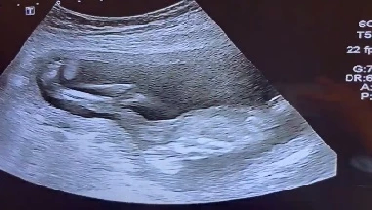 ตกใจ ลูกสาวในท้อง "ใหม่ สุคนธวา" ฟาดตั้งแต่อยู่ในท้องแม่แบบนี้ แม่ยอมจ้า