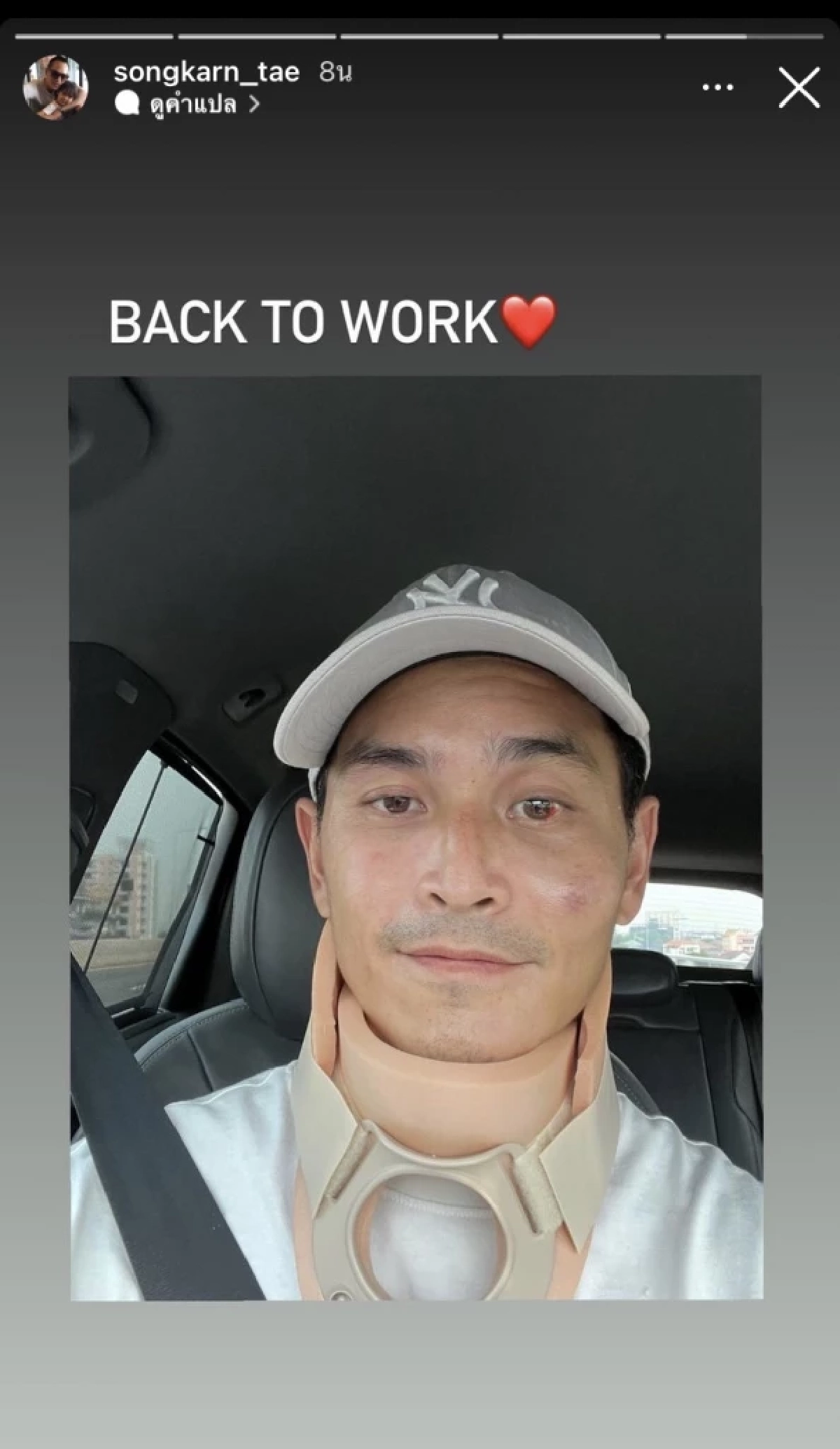 อัปเดต "สงกรานต์ " โพสต์สตอรี่ พร้อมทำงานแล้ว หลังประสบอุบัติเหตุนอน ICU