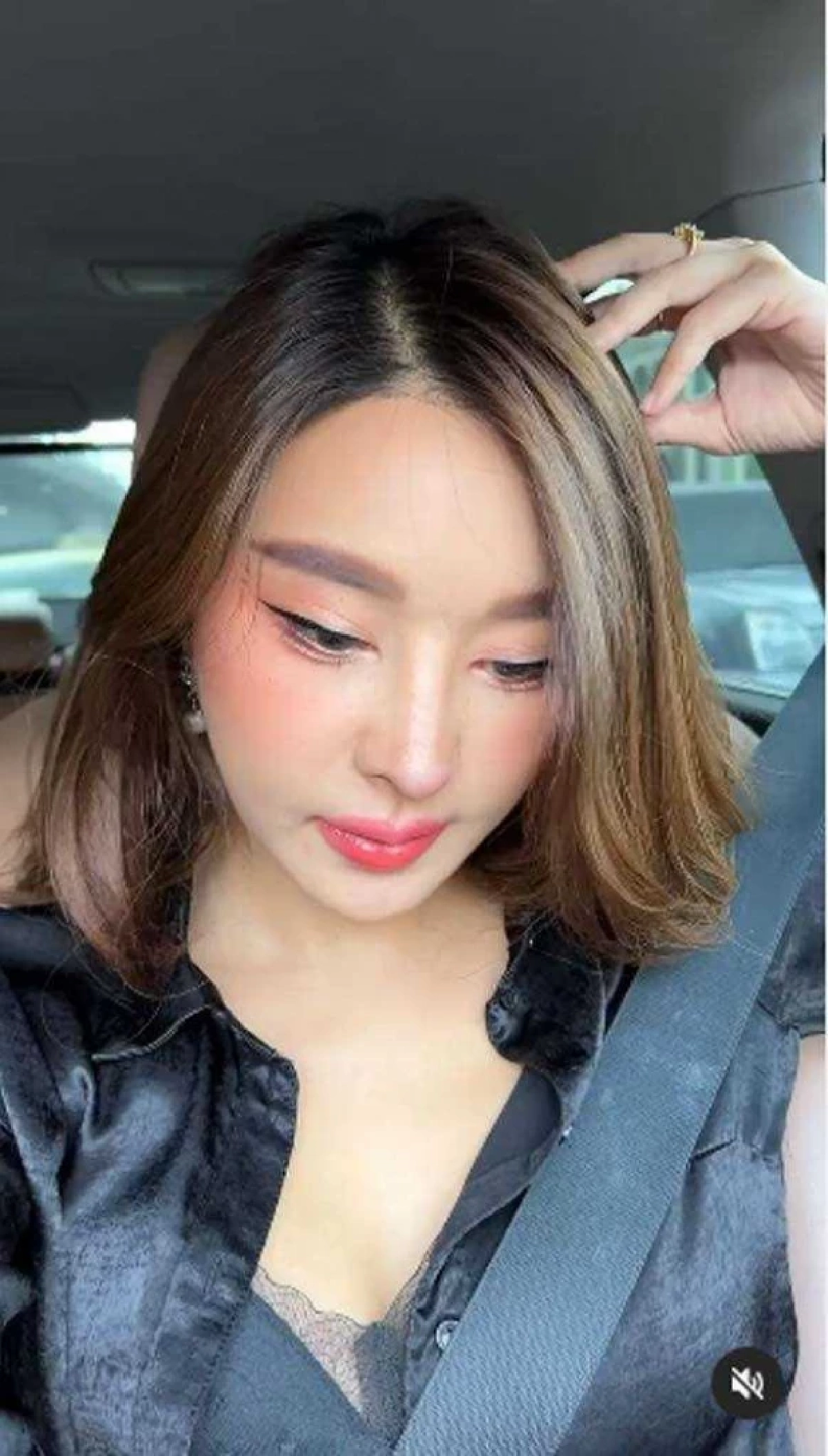 ส่องจมูกใหม่ "หญิงแย้" หลังแก้ทรงได้ 16 วัน สวยขึ้นแค่ไหน
