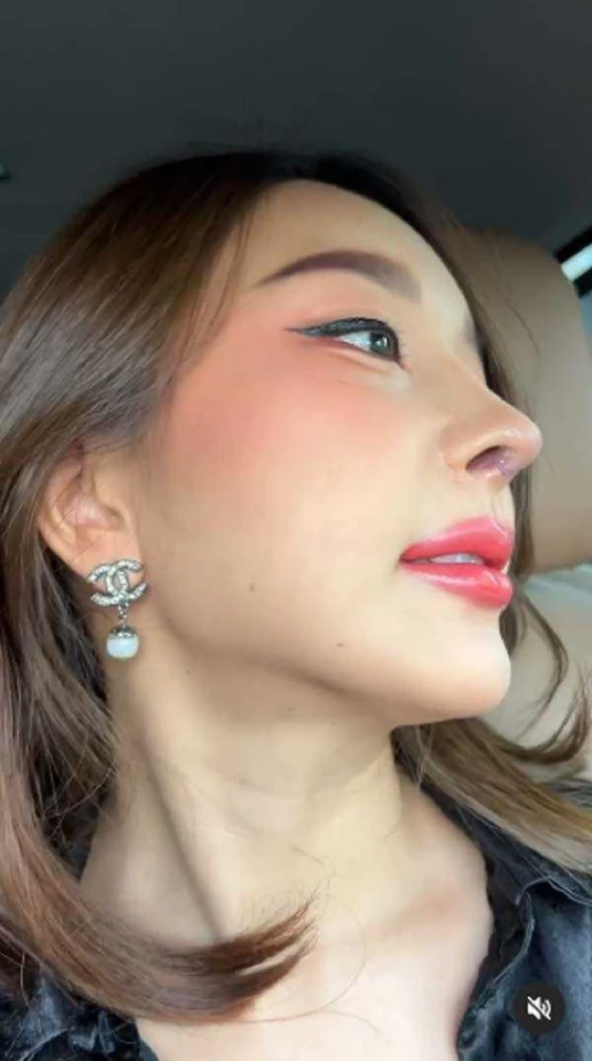 ส่องจมูกใหม่ "หญิงแย้" หลังแก้ทรงได้ 16 วัน สวยขึ้นแค่ไหน