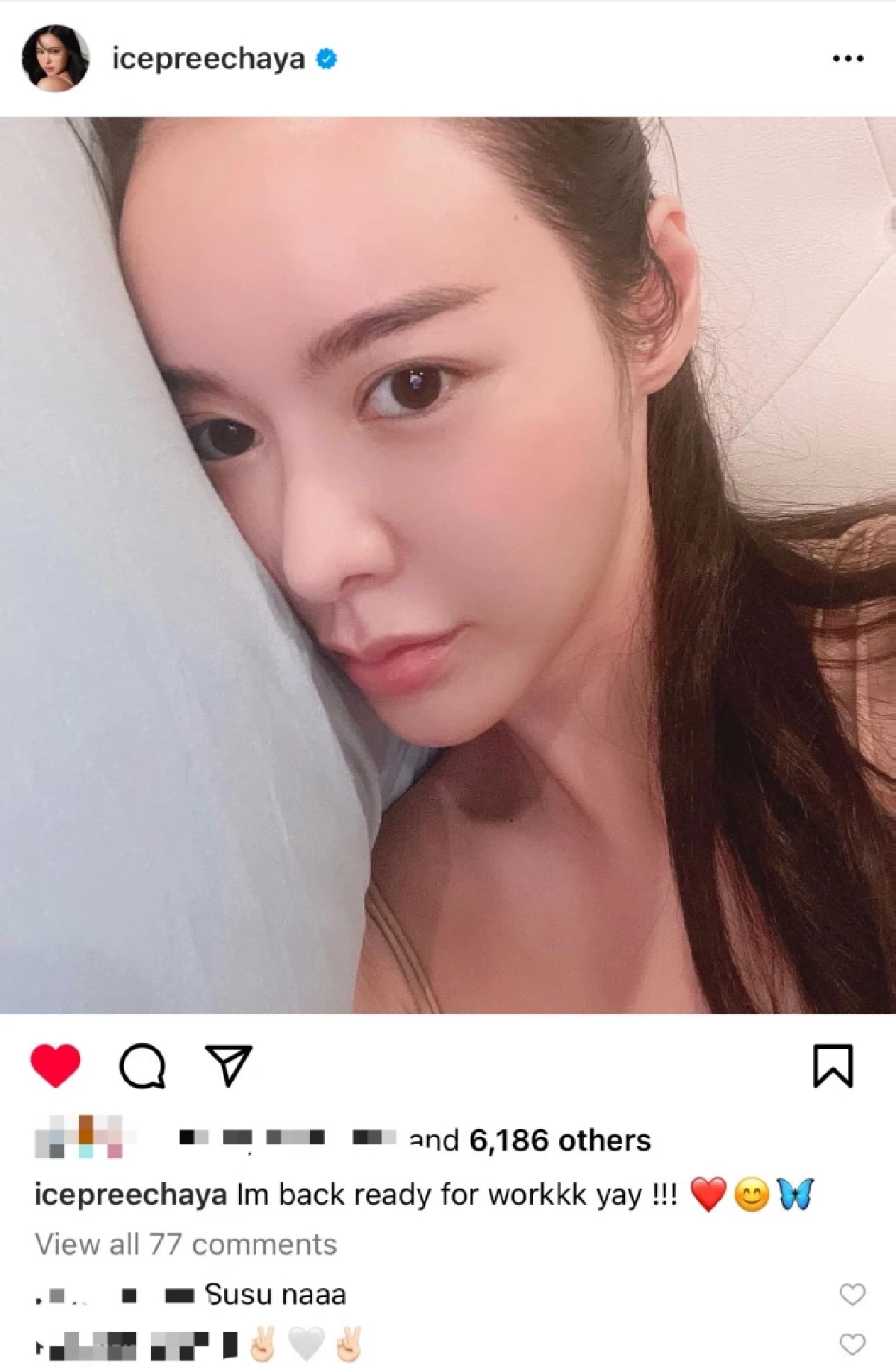 ตกใจ "ไอซ์ ปรีชญา" ฉีดมอร์ฟีนทุก 6 ชั่วโมง ป่วยเลือดเป็นกรด เผยเหตุน้อยใจ