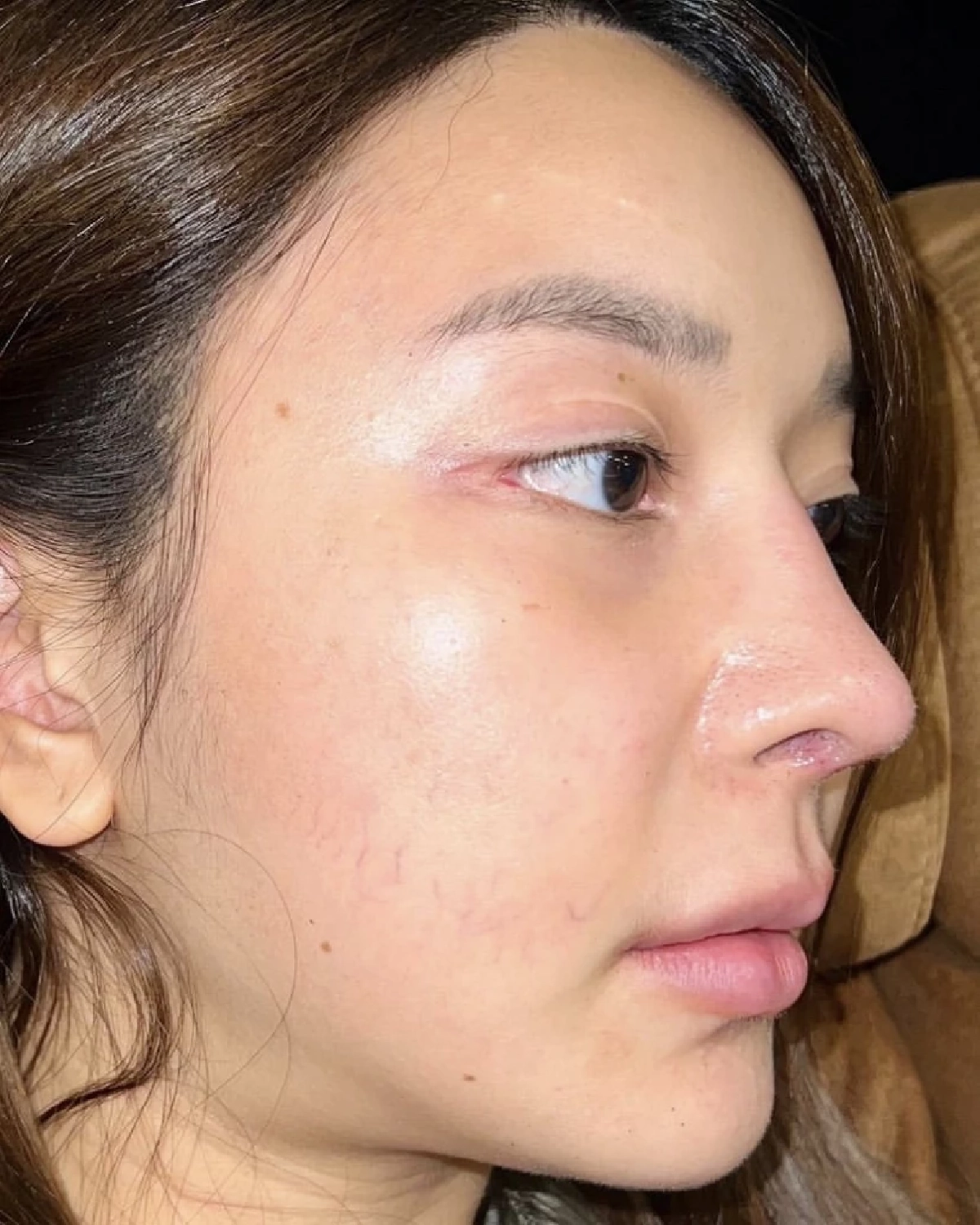 "หญิงแย้ นนทพร" ตอบแล้วทำไมราคาทำจมูกใหม่ถึงแพงกว่า 500,000 บาท