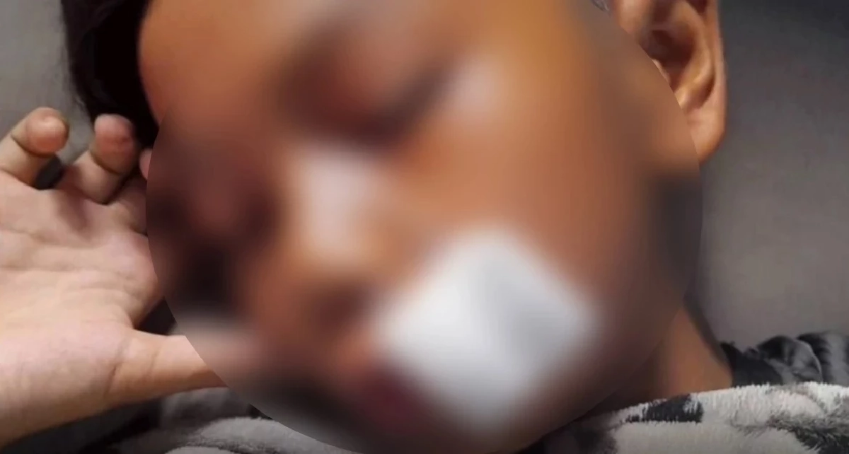 ม.6 กระทืบ ม.1 "สลบเหมือด" ปมลูกตระกร้อชนรถ จยย.ไม่สำนึกโพสต์เย้ยซ้ำ