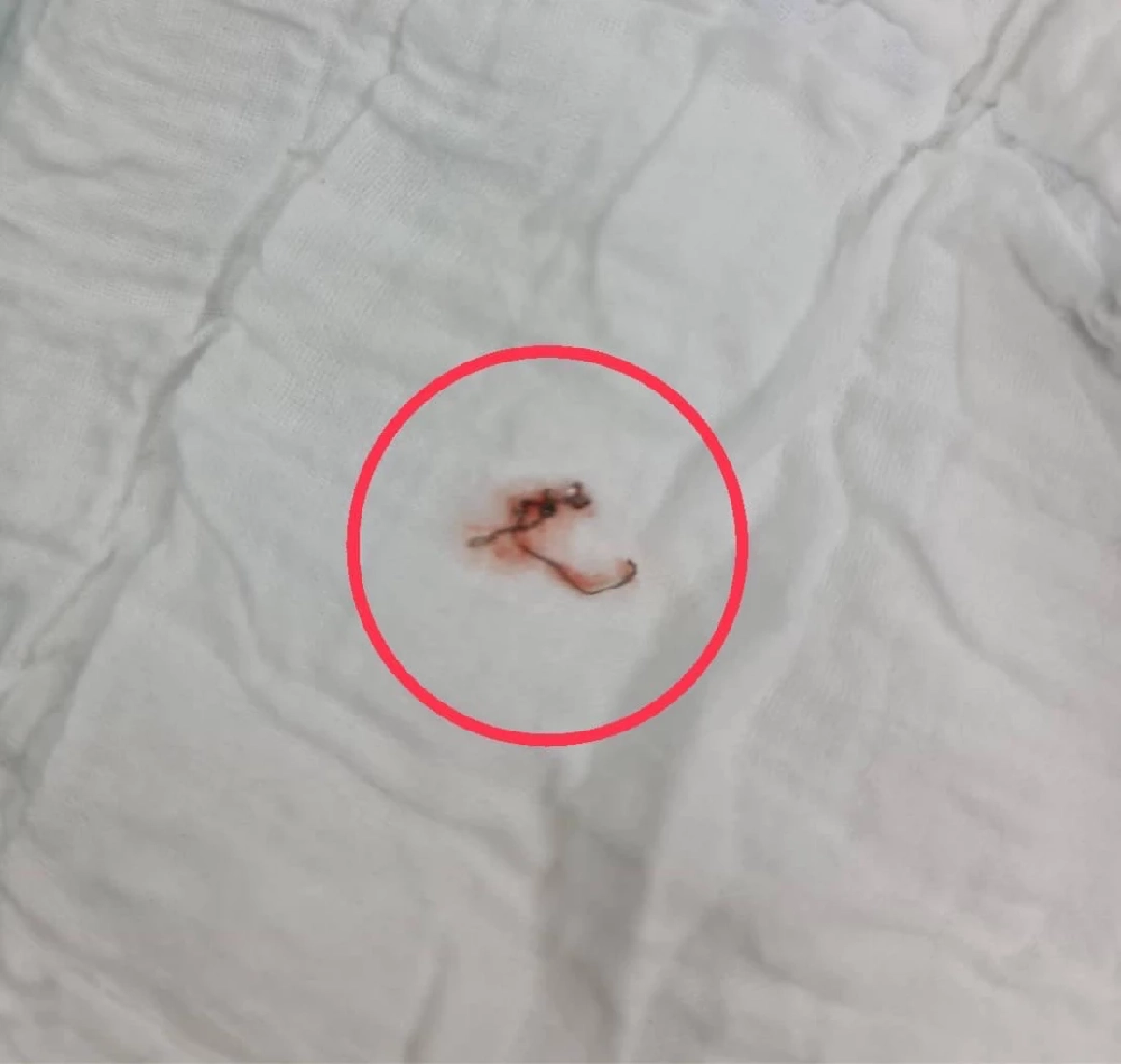 เศษฝอยขัดหม้อ