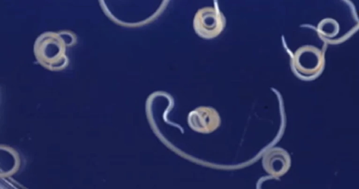 พยาธิอะนิซาคิส