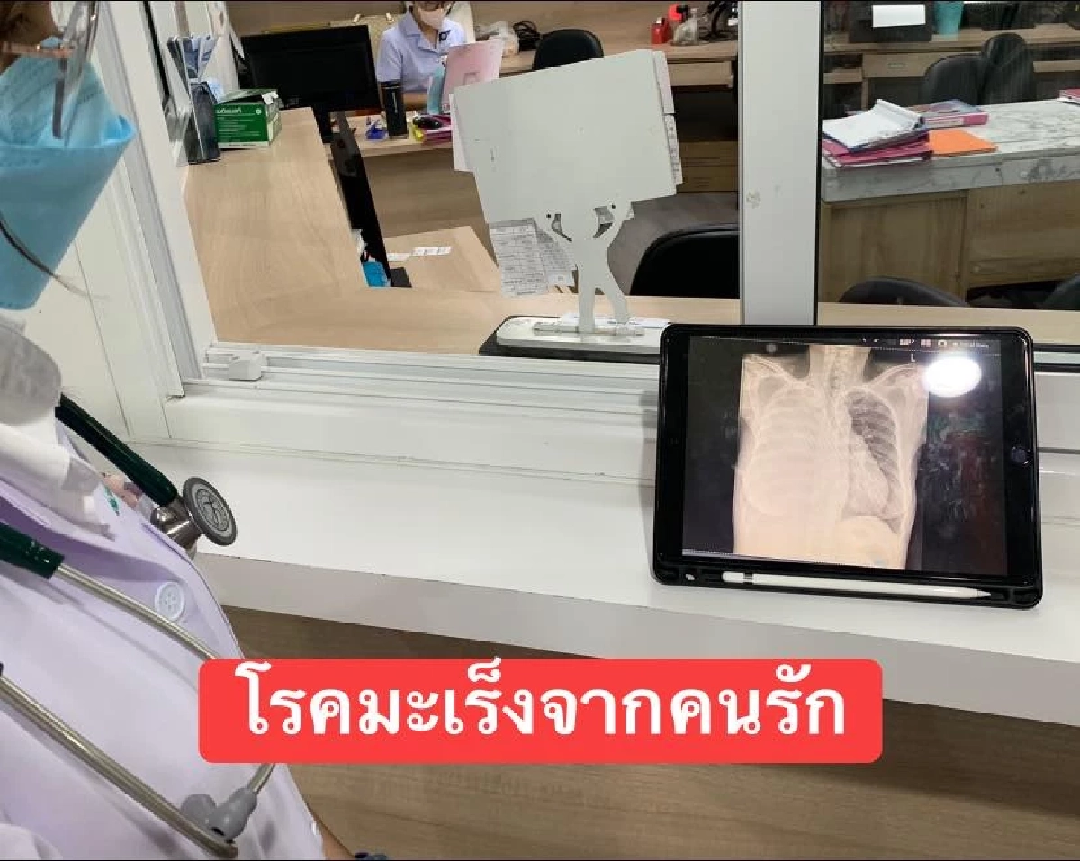 มะเร็งปอด