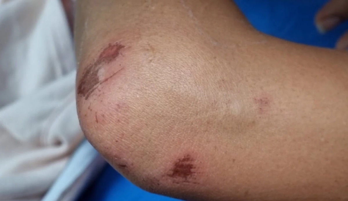 แม่ค้า'ลอตเตอรี่' โดนรุมทำร้ายสลบเหมือดเหตุเข้าใจผิดตั้งแผงขายทับที่