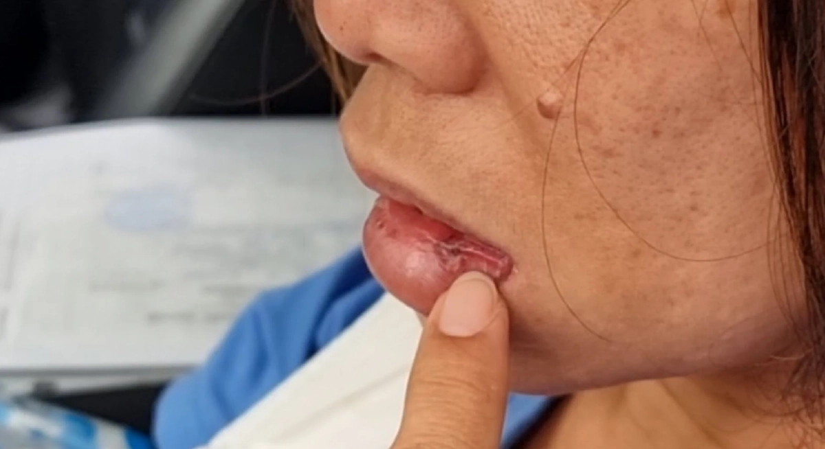 แม่ค้า'ลอตเตอรี่' โดนรุมทำร้ายสลบเหมือดเหตุเข้าใจผิดตั้งแผงขายทับที่