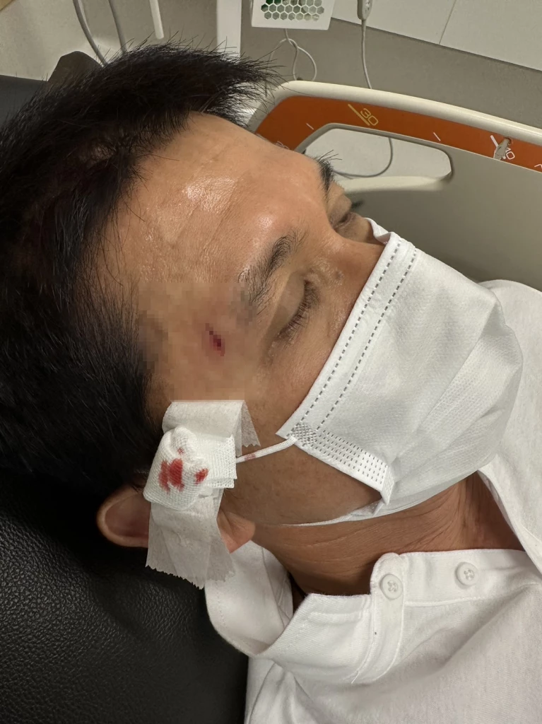 นายชนินทร์ รุ่งแสง คิ้วแตก