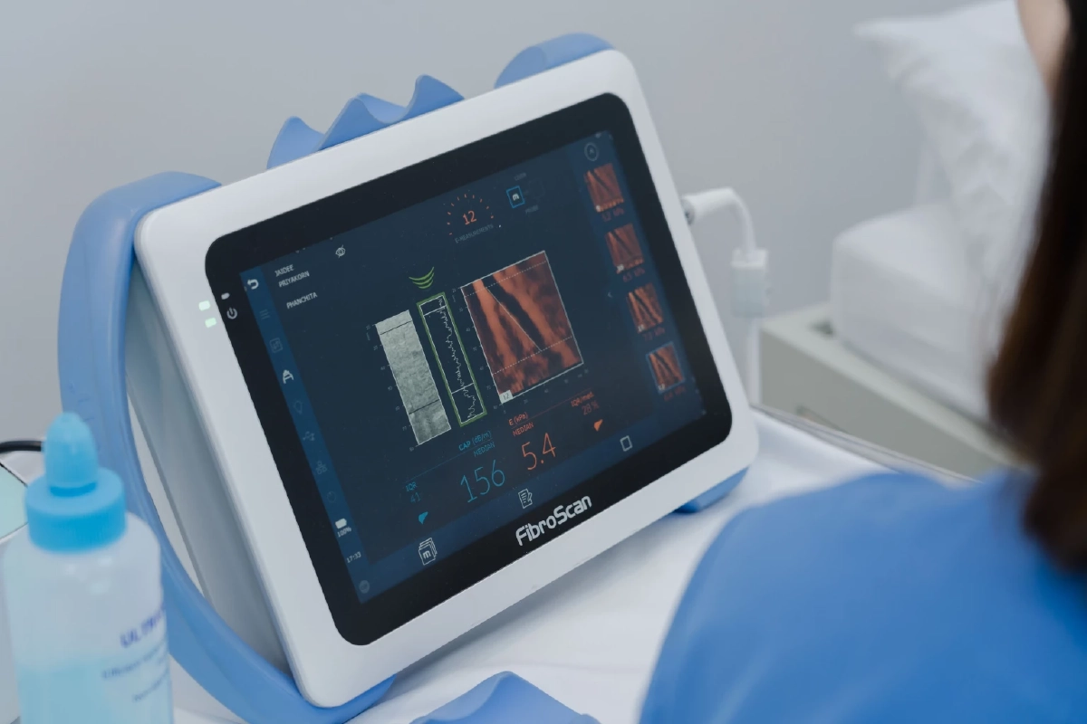 การตรวจวัดปริมาณไขมันสะสมในตับ