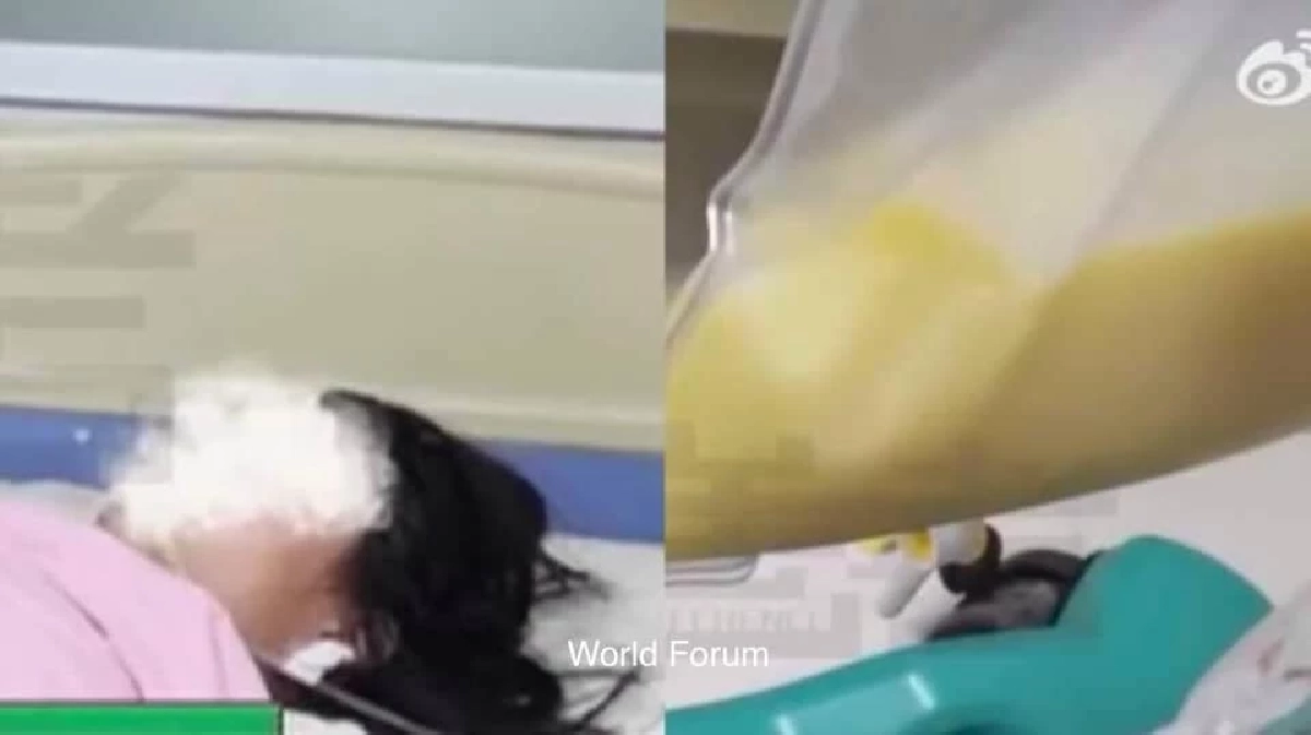 ขอบคุณภาพจาก World Forum ข่าวสารต่างประเทศ