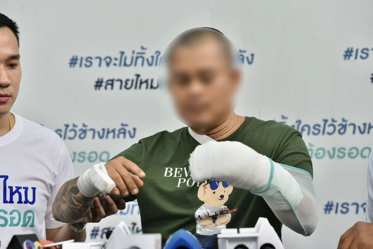 รปภ.หนุ่ม ร้องสายไหมต้องรอด โดนเพื่อนร่วมงานฟันนิ้วขาด 