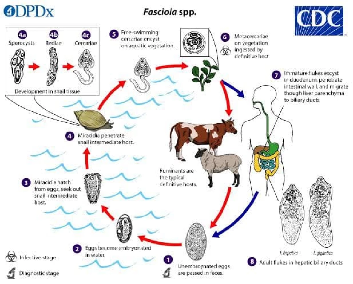 พยาธิใบไม้ในตับฟาสซิโอลา (Fascioliasis)