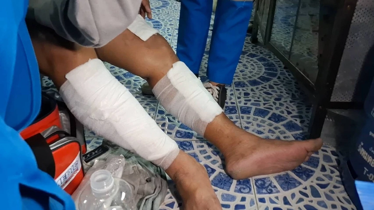 สาวแค้นผัวเก่า บุกบ้าน "สาดน้ำกรด" กระเด็นโดนลูก 8 ขวบ