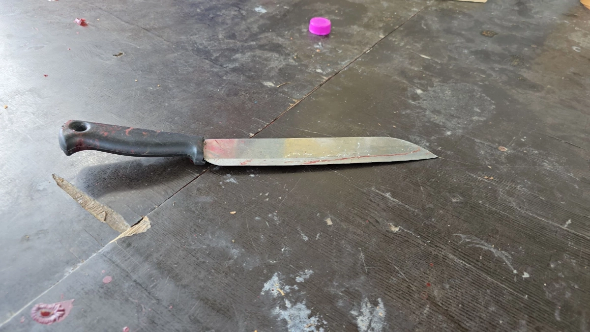 เมียฉุน ผัวดื่มฉลองปีใหม่ไม่ยอมกลับบ้าน คว้ามีดฟันหน้าจมูกแหว่ง