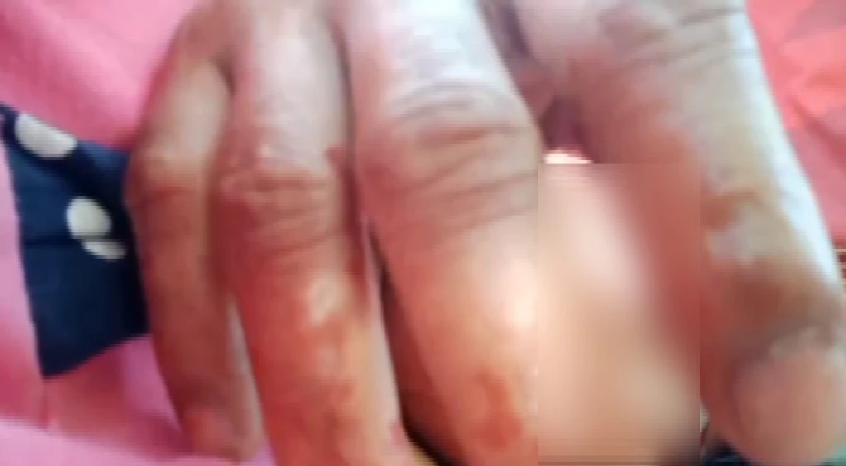 บุกช่วยเด็ก 7 ขวบ พ่อใช้เลือดหมูทาตัว ถ่ายคลิปขู่เมียจะกรีดแขนลูก