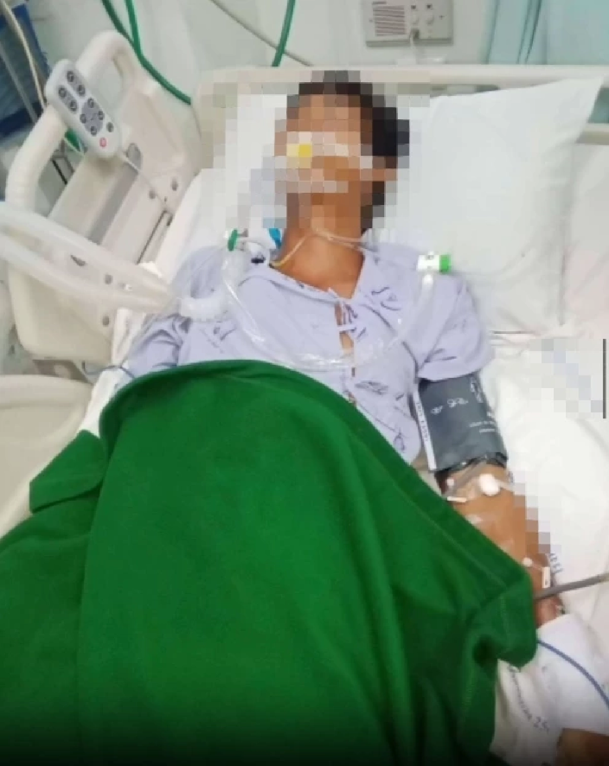 นายจ้างเล่า ลูกน้องถูกงูกัด รพ.ให้กินพารา สุดท้ายอาการโคม่า