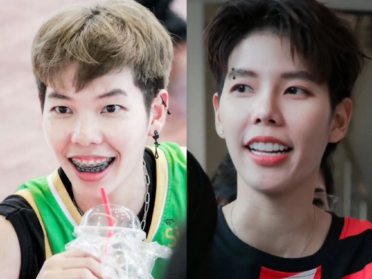 โดนบูลลี่มาทั้งชีวิต! \"ป๊ายปาย\" ยึดอกรับผ่าตัดเหงือก \"นุ๊ก ธนดล\" อวยยศ